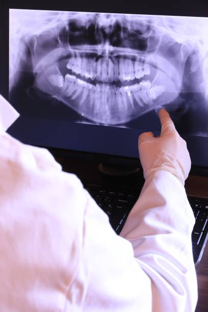 Best Broken or Chipped Tooth Repair in Farmers Loop, AK